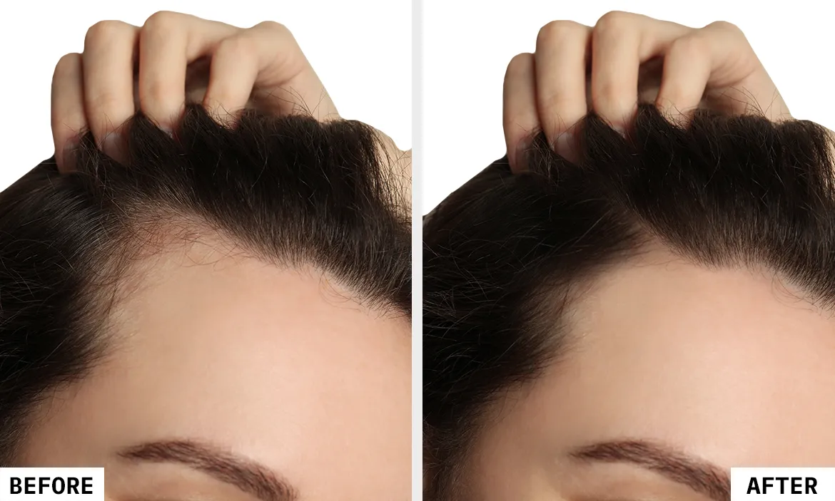 Before_After_01_HB