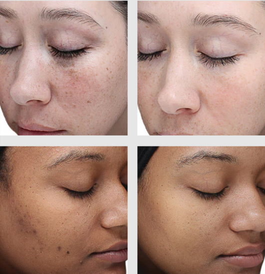 vipeel medicalspabuffalo